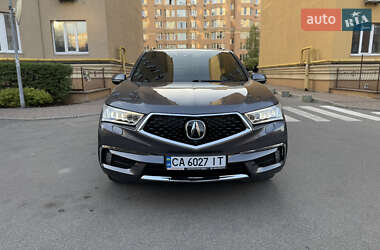 Acura MDX 2017