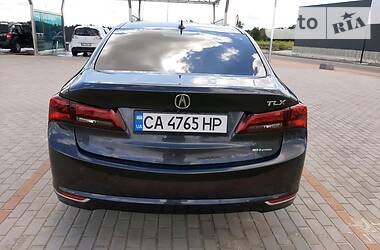 Седан Acura TLX 2015 в Києві