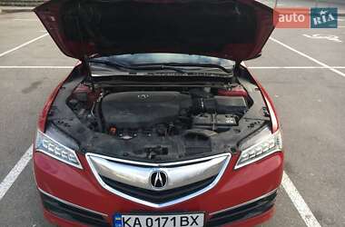 Седан Acura TLX 2016 в Києві