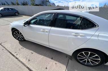 Седан Acura TLX 2015 в Одессе