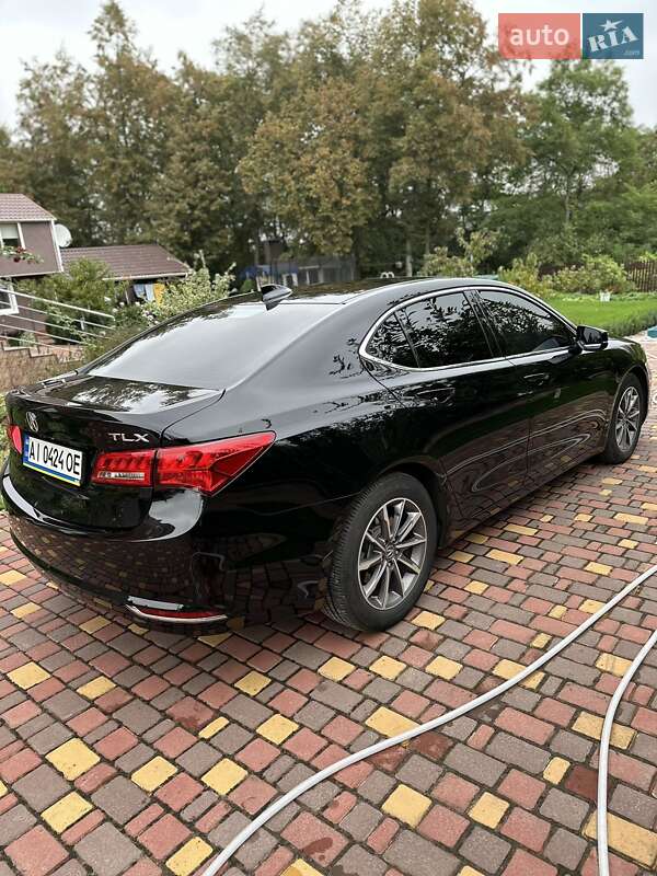 Седан Acura TLX 2020 в Фастове фото 3 Седан Acura TLX 2020 в Фастове