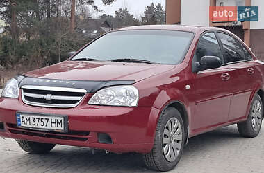 Седан Chevrolet Lacetti 2006 в Житомирі