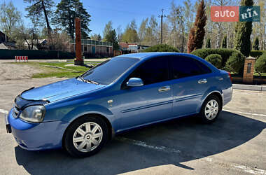 Седан Chevrolet Lacetti 2004 в Лебедині