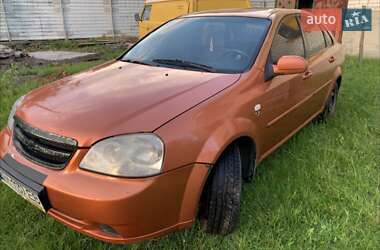 Седан Chevrolet Lacetti 2006 в Житомире