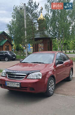 Седан Chevrolet Lacetti 2006 в Житомирі