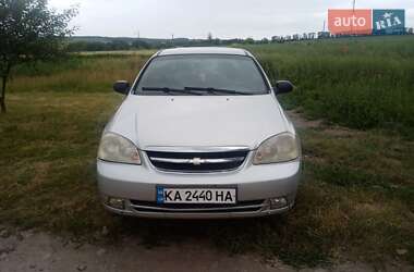Седан Chevrolet Lacetti 2005 в Вінниці