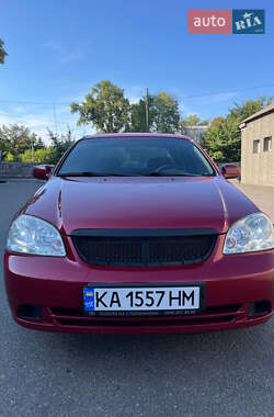 Седан Chevrolet Lacetti 2011 в Києві