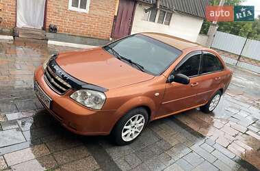 Седан Chevrolet Lacetti 2006 в Житомире