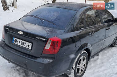 Седан Chevrolet Lacetti 2005 в Житомирі