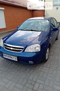 Седан Chevrolet Nubira 2005 в Житомирі