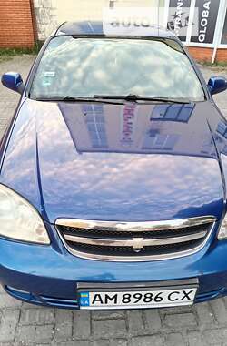 Седан Chevrolet Nubira 2005 в Житомирі