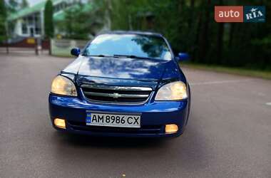 Седан Chevrolet Nubira 2005 в Житомирі