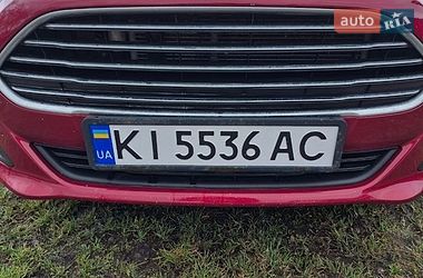 Хетчбек Ford Fiesta 2017 в Фастові