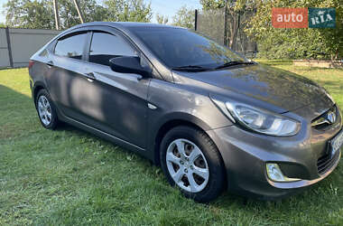 Седан Hyundai Accent 2014 в Києві