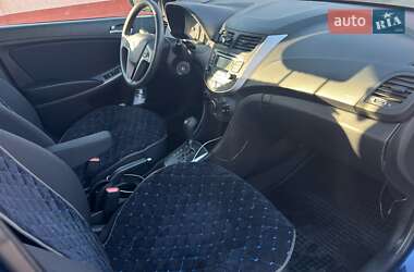 Хетчбек Hyundai Accent 2017 в 
