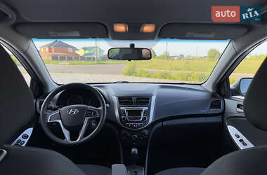 Хэтчбек Hyundai Accent 2017 в 
