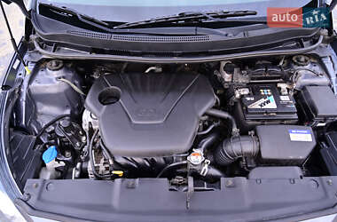 Хэтчбек Hyundai Accent 2017 в 