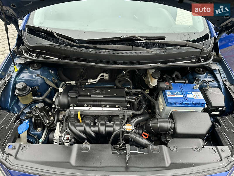 Седан Hyundai Accent 2012 в Виннице фото 14 Седан Hyundai Accent 2012 в Виннице