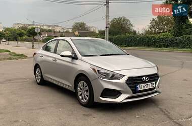 Седан Hyundai Accent 2021 в Житомирі