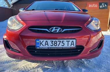 Седан Hyundai Accent 2013 в Житомирі