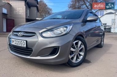 Хэтчбек Hyundai Accent 2017 в Бахмаче