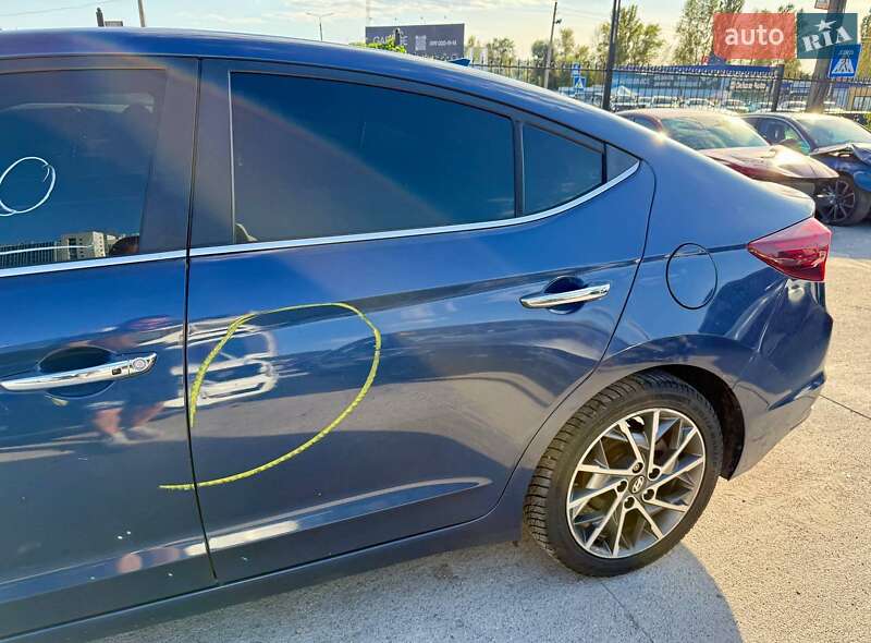 Седан Hyundai Elantra 2018 в Києві фото 7 Седан Hyundai Elantra 2018 в Києві