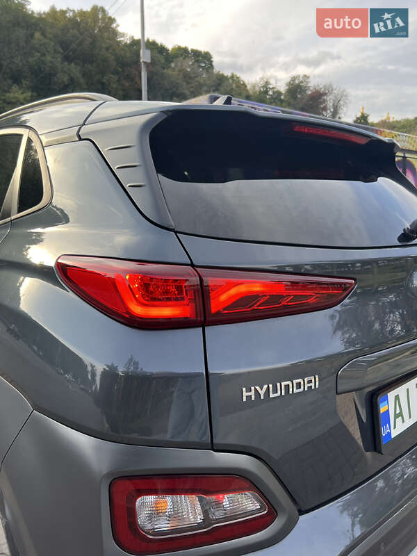 Позашляховик / Кросовер Hyundai Kona Electric 2018 в Обухові фото 7 Позашляховик / Кросовер Hyundai Kona Electric 2018 в Обухові