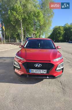 Позашляховик / Кросовер Hyundai Kona 2018 в Хмельницькому