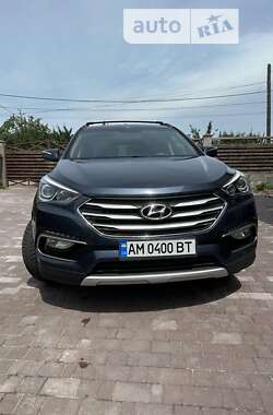 Внедорожник / Кроссовер Hyundai Santa FE 2017 в Житомире