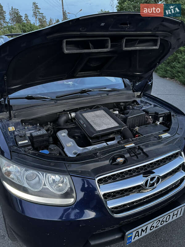 Внедорожник / Кроссовер Hyundai Santa FE 2006 в Малине фото 12 Внедорожник / Кроссовер Hyundai Santa FE 2006 в Малине