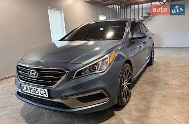 Седан Hyundai Sonata 2017 в Черкассах