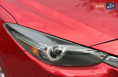 Хетчбек Mazda 3 2017 в Вінниці фото 21 Хетчбек Mazda 3 2017 в Вінниці