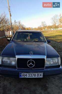 Седан Mercedes-Benz E-Class 1992 в Житомирі